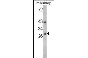 Western blot analysis of ENDOG Antibody (C-term) (Cat. (Endonuclease G 抗体  (C-Term))