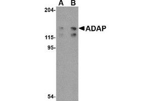 Western Blotting (WB) image for anti-FYN-Binding Protein (FYB) (C-Term) antibody (ABIN1030221) (FYB 抗体  (C-Term))