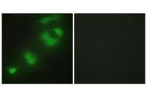 Immunofluorescence analysis of HepG2 cells, using CREBZF antibody. (CREBZF 抗体)