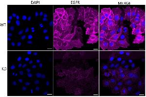 Immunocytochemical staining of HepG2 cells using EGFR antibody (ABIN7798479), 1:1,000), Top panel: wild-type (WT), Bottom panal: EGFR shRNA knockdown (KD).