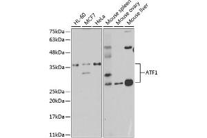 Western blot analysis of extracts of various cell lines, using  antibody (ABIN6127376, ABIN6137228, ABIN6137229 and ABIN6221472) at 1:1000 dilution. (AFT1 抗体  (AA 1-210))