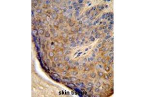 Formalin-fixed and paraffin-embedded human skin tissue reacted with TCHP Antibody (Center), which was peroxidase-conjugated to the secondary antibody, followed by DAB staining.
