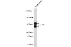 Western blot analysis of extracts of Mouse ovary, using c-Myc antibody (ABIN7268711) at 1:1000 dilution. (c-MYC 抗体)