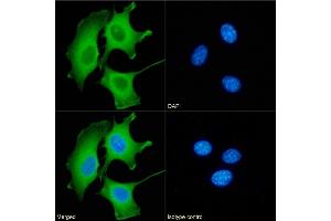Immunofluorescence staining of fixed NIH3T3 cells with anti-Galectin 9 antibody RG9-35. (Recombinant Galectin 9 抗体)