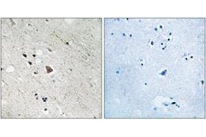 Immunohistochemistry analysis of paraffin-embedded human brain, using FLT3 (Phospho-Tyr969) Antibody. (FLT3 抗体  (pTyr969))