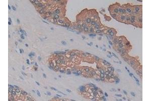 Detection of KLK10 in Human Prostate Tissue using Polyclonal Antibody to Kallikrein 10 (KLK10) (Kallikrein 10 抗体  (AA 35-276))