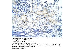 Human kidney (GTF2IRD1 抗体  (N-Term))