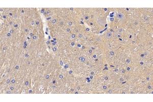 Detection of CD90 in Mouse Cerebellum Tissue using Polyclonal Antibody to Cluster of Differentiation 90 (CD90) (CD90 抗体  (AA 20-131))