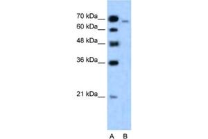 Western Blotting (WB) image for anti-Afadin (MLLT4) antibody (ABIN2460899) (Afadin 抗体)