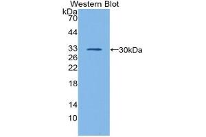 Western blot analysis of the recombinant protein. (GATA1 抗体  (AA 20-265))