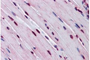 Mouse Skeletal Muscle: Formalin-Fixed, Paraffin-Embedded (FFPE) (TTF1 抗体  (AA 51-100))