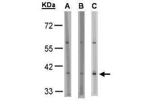 WB Image Sample(30 μg of whole cell lysate) A:HeLa S3 , B:MOLT4, C:Raji , 10% SDS PAGE antibody diluted at 1:1000 (SUCNR1 抗体)