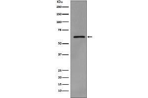 Western Blotting (WB) image for anti-Proto-oncogene tyrosine-protein kinase Src (Src) (pTyr419) antibody (ABIN7606748)