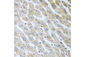 Immunohistochemistry of paraffin-embedded human liver using Eif2ak2 antibody. (EIF2AK2 抗体  (AA 1-270))