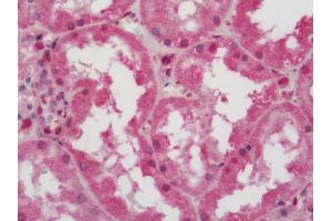 Immunohistochemistry (Paraffin-embedded Sections) (IHC (p)) image for anti-ATPase, H+ Transporting, Lysosomal 16kDa, V0 Subunit C (ATP6V0C) (AA 100-126) antibody (ABIN2589410)