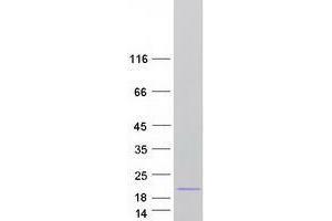 Thioredoxin-Like 4B (TXNL4B) (Transcript Variant 3) protein (Myc-DYKDDDDK Tag)