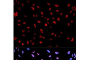 Immunofluorescence analysis of U2OS cells using Phospho-MEF2C(S396) Polyclonal Antibody (MEF2C 抗体  (pSer396))