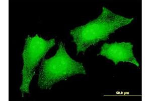 Immunofluorescence of monoclonal antibody to CRKL on HeLa cell. (CrkL 抗体  (AA 204-303))