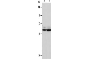 Gel: 8 % SDS-PAGE, Lysate: 40 μg, Lane 1-2: Hela cells, Jurkat cells, Primary antibody: ABIN7130740(PSMD3 Antibody) at dilution 1/300, Secondary antibody: Goat anti rabbit IgG at 1/8000 dilution, Exposure time: 5 seconds (PSMD3 抗体)