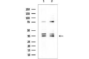 anti-LIM and SH3 Protein 1 (LASP1) antibody
