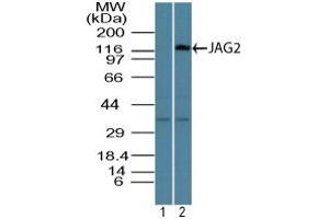 Image no. 1 for anti-Jagged 2 (JAG2) (AA 150-200) antibody (ABIN960240)