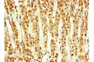 Immunohistochemistry of paraffin-embedded human adrenal gland tissue using ABIN7143179 at dilution of 1:100