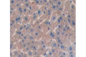 #VALUE! (Complement Factor I 抗体  (AA 358-603))