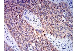 Immunohistochemistry (IHC) image for anti-BCL2-Associated X Protein (BAX) (AA 13-160) antibody (ABIN5611252)