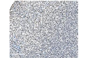 IHC analysis of NRF1 using anti-NRF1 antibody (ABIN7600874).