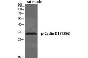Western Blot (WB) analysis of specific cells using Phospho-Cyclin D1 (T286) Polyclonal Antibody. (Cyclin D1 抗体  (pThr286))