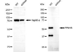 Western blotting analysis using PPM1B antibody (ABIN7800033). (PPM1B 抗体)