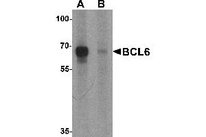 Western blot analysis of BCL6 in rat lung tissue lysate with Bcl6 antibody at 1 µg/mL in (A) the absence and (B) the presence of blocking peptide (BCL6 抗体  (Middle Region))