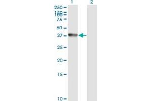Western Blot analysis of ANXA2 expression in transfected 293T cell line by ANXA2 monoclonal antibody (M02), clone 1G7. (Annexin A2 抗体  (AA 19-357))