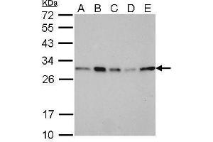 Western Blotting (WB) image for anti-Stratifin (SFN) antibody (ABIN2854867)