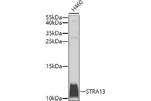 Western blot analysis of extracts of H460 cells, using STR antibody (ABIN6133039, ABIN6148631, ABIN6148632 and ABIN6225238) at 1:1000 dilution. (STRA13 抗体  (AA 1-63))