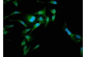 Immunofluorescence staining of Hela cells with ABIN7167302 at 1:185, counter-stained with DAPI. (RAB35 抗体  (AA 1-201))