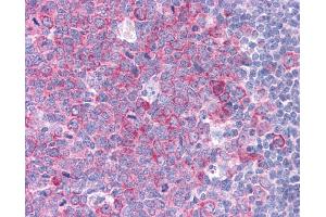 Immunohistochemistry (IHC) image for anti-Heat Shock Protein 90kDa alpha (Cytosolic), Class A Member 1 (HSP90AA1) (N-Term) antibody (ABIN2779296)