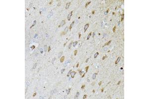 Immunohistochemistry of paraffin-embedded rat brain using ND5 antibody (ABIN5975833) at dilution of 1/100 (40x lens). (MT-ND5 抗体)