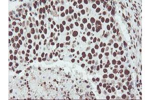 Image no. 7 for anti-Non-POU Domain Containing, Octamer-Binding (NONO) (AA 184-385) antibody (ABIN1491073)