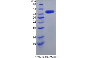 Image no. 1 for serine/arginine-Rich Protein Specific Kinase 3 (SRPK3) (AA 247-517) protein (His tag) (ABIN6238289) (SRPK3 Protein (AA 247-517) (His tag))