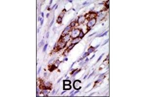 Immunohistochemistry (Paraffin-embedded Sections) (IHC (p)) image for anti-G Protein-Coupled Receptor Kinase 5 (GRK5) (AA 559-590), (C-Term) antibody (ABIN390988)