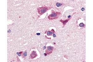 Immunohistochemistry of TRAIL in human brain tissue with this product at 20 μg/ml. (TRAIL 抗体  (C-Term))