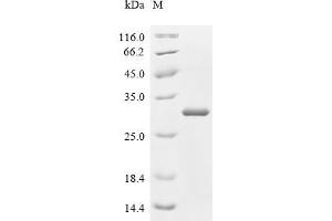 (Tris-Glycine gel) Discontinuous SDS-PAGE (reduced) with 5 % enrichment gel and 15 % separation gel.