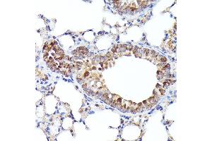 Immunohistochemistry of paraffin-embedded mouse lung using BNIP3L Rabbit pAb (ABIN6129989, ABIN6137622, ABIN6137623 and ABIN6221881) at dilution of 1:100 (40x lens). (BNIP3L/NIX 抗体  (AA 1-187))