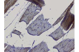 IHC analysis of NRF1 using anti-NRF1 antibody (ABIN6719347).