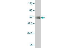 Western Blot detection against Immunogen (56. (LIM Domain Binding 3 Protein 抗体  (AA 1-283))