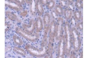 DAB staining on IHC-P; Samples: Rat Kidney Tissue (ABCG8 抗体  (AA 1-271))