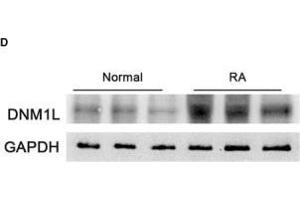 Enhanced mitochondrial fission in STs of RA patients correlates with disease severity. (GAPDH 抗体)