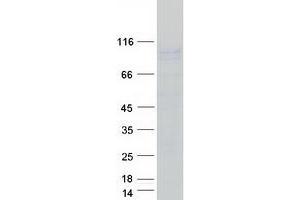 Sodium Potassium ATPase, alpha1 (ATP1A1) (Transcript Variant 1) protein (Myc-DYKDDDDK Tag)