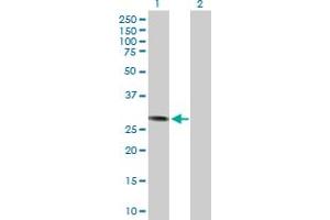 Western Blot analysis of CCND3 expression in transfected 293T cell line by CCND3 MaxPab polyclonal antibody. (Cyclin D3 抗体  (AA 1-292))